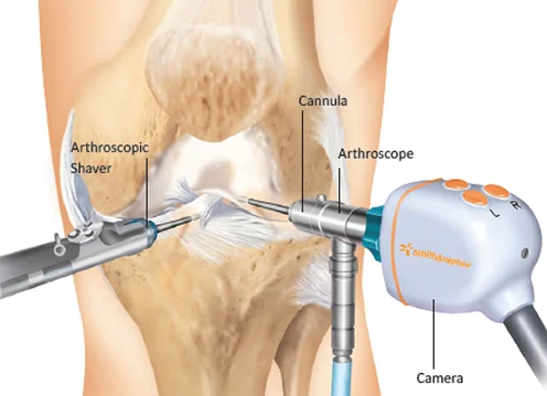 Knee