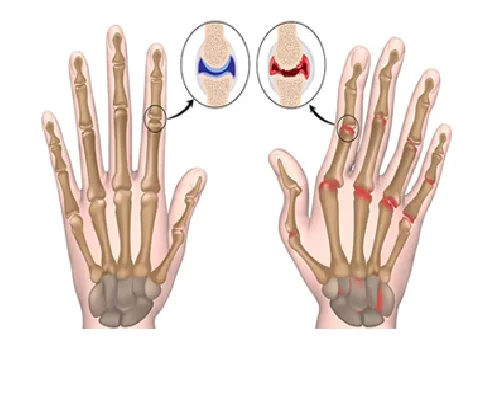 Rheumatology